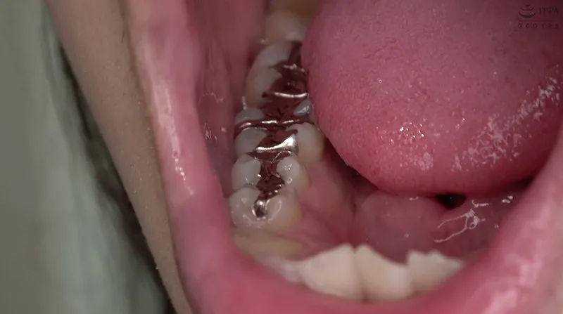 [AD-692] 牙齒戀物癖 - 牙齒和口腔的喉嚨觀察 - 長野阿亞卡 - R18